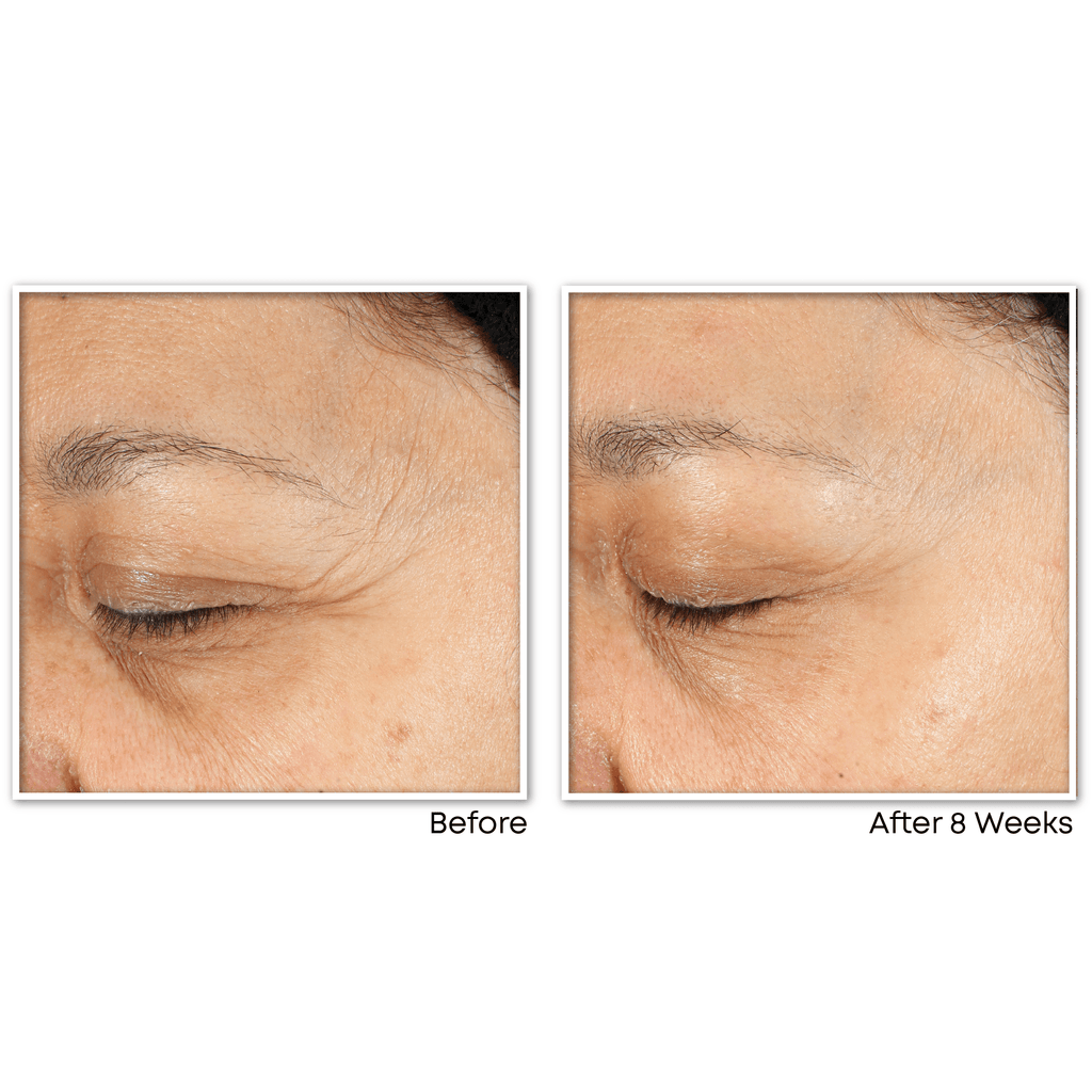 RoC Multi Correxion Revive & Glow Daily Serum (0.33 oz)