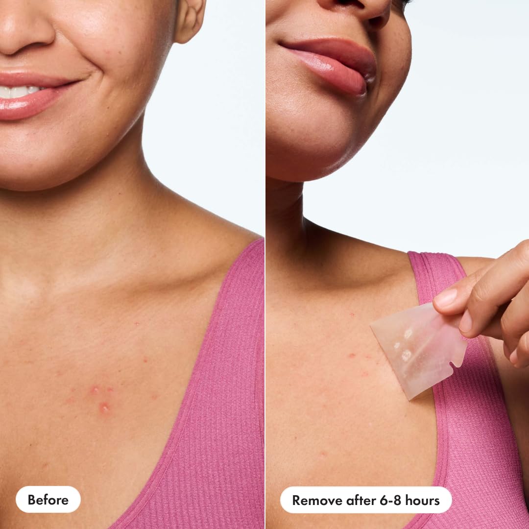 HERO Mighty Body Patch