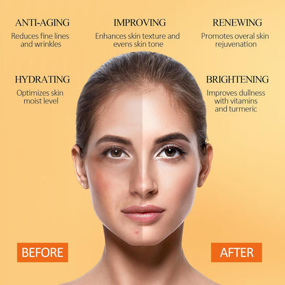 SHVYOG Vitamin C Clay Mask With Turmeric