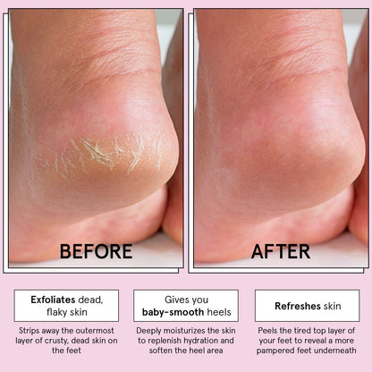 GRACE & STELLA Exfoliating Foot Peel Mask