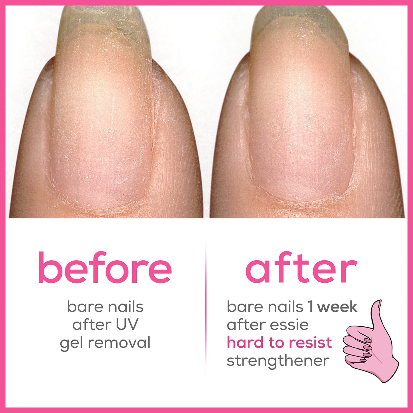ESSIE Nail Care - Nail Treatment