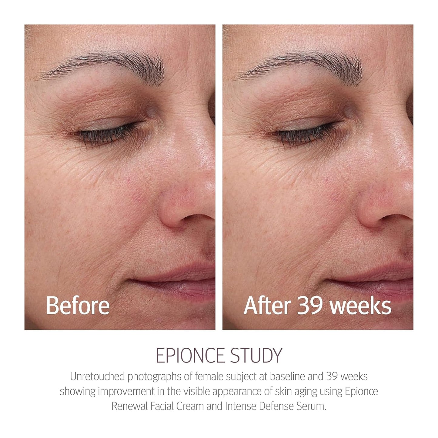 EPIONCE Renewal Facial Cream