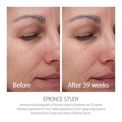 EPIONCE Renewal Facial Cream