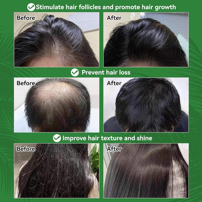 WTEGIGA 100% Natural Batana Oil