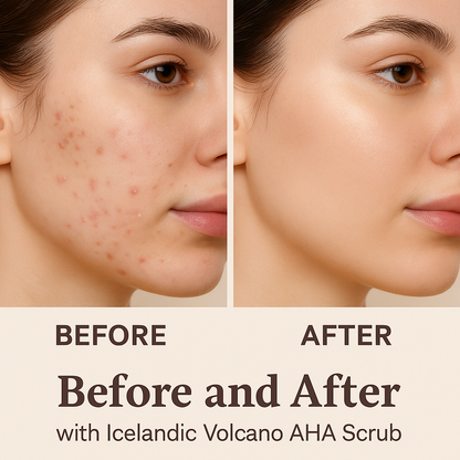 Icelandic Volcano AHA Face & Body Scrub