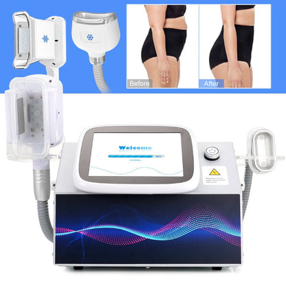 Shape Tactics 2-in-1 Cryolipolysis Cooling System for Chin and Body Contouring
