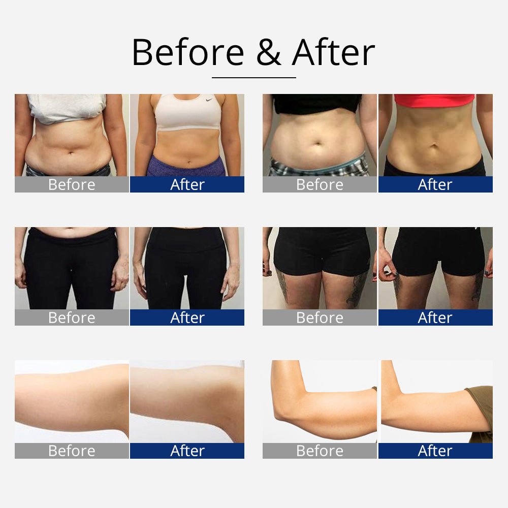 Shape Tactics 360° RF Cavitation & Vacuum Body Contouring System