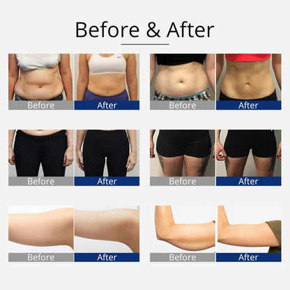 Shape Tactics 360° RF Cavitation & Vacuum Body Contouring System