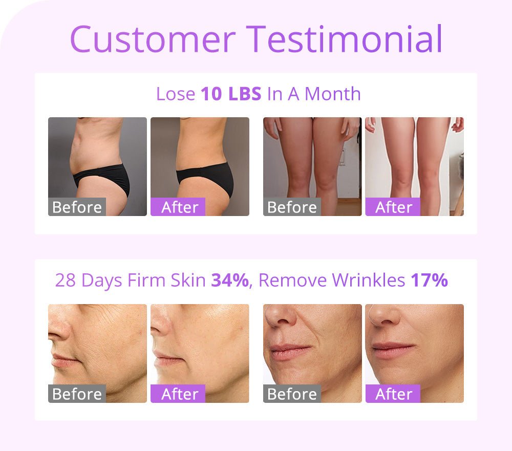 Shape Tactics 5-in-1 30K Cavitation RF System with 160mW Lipo Laser