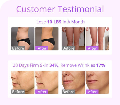 Shape Tactics 5-in-1 30K Cavitation RF System with 160mW Lipo Laser