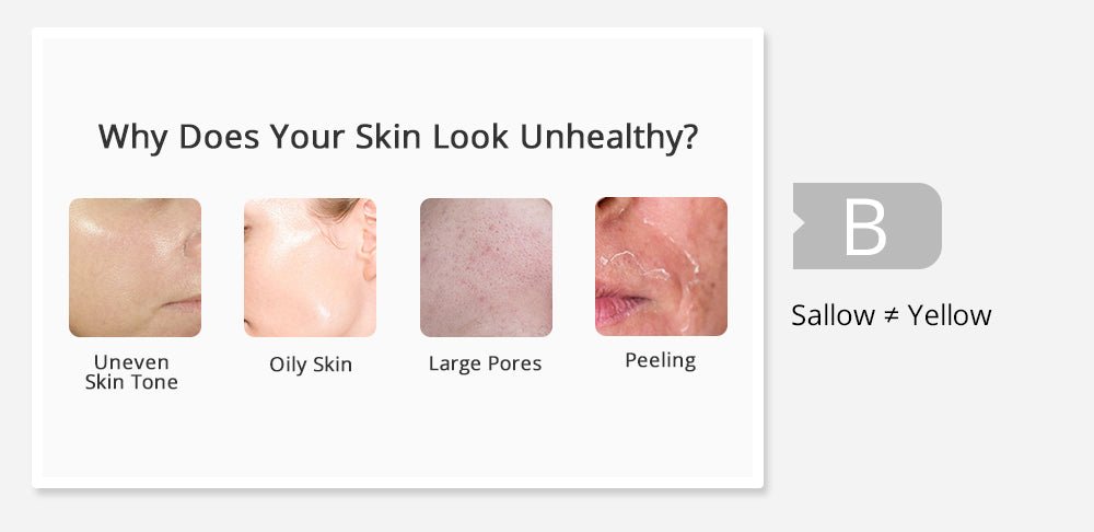 Shape Tactics 5-in-1 Diamond Microdermabrasion and Ultrasonic Skincare System