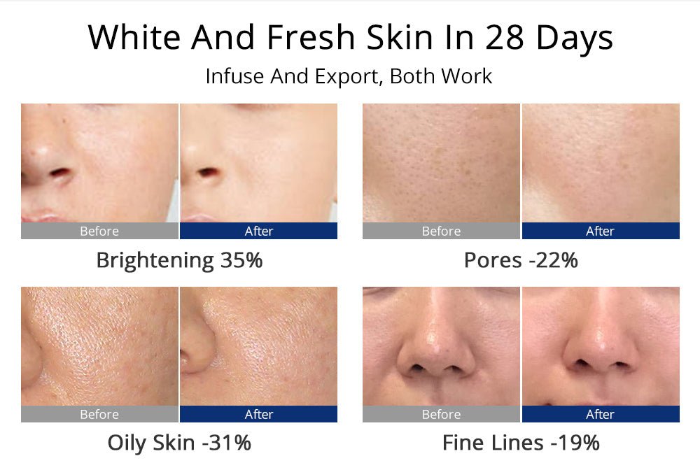 Shape Tactics 5-in-1 Diamond Microdermabrasion and Ultrasonic Skincare System