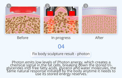 Shape Tactics 6-in-1 Unoisetion Cavitation 2.0 Vacuum RF System