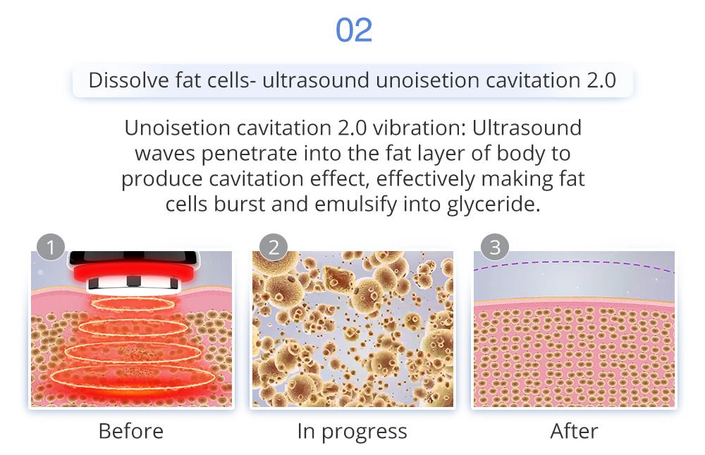 Shape Tactics 6-in-1 Unoisetion Cavitation 2.0 Vacuum RF System