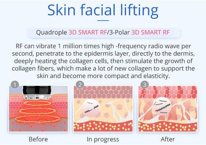 Shape Tactics 6-in-1 Unoisetion Cavitation 2.0 Vacuum RF System