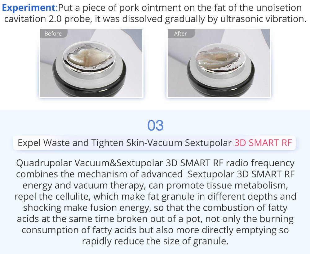Shape Tactics 6-in-1 Unoisetion Cavitation 2.0 Vacuum RF System