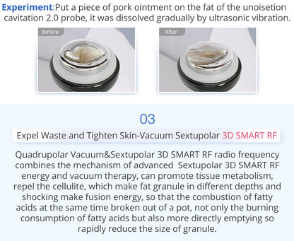 Shape Tactics 6-in-1 Unoisetion Cavitation 2.0 Vacuum RF System
