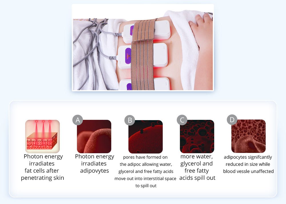 Shape Tactics 6-in-1 Unoisetion Cavitation 2.0 Vacuum RF System