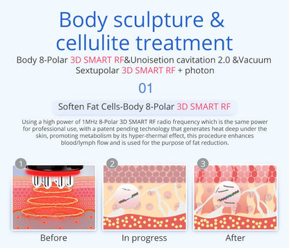 Shape Tactics 6-in-1 Unoisetion Cavitation 2.0 Vacuum RF System