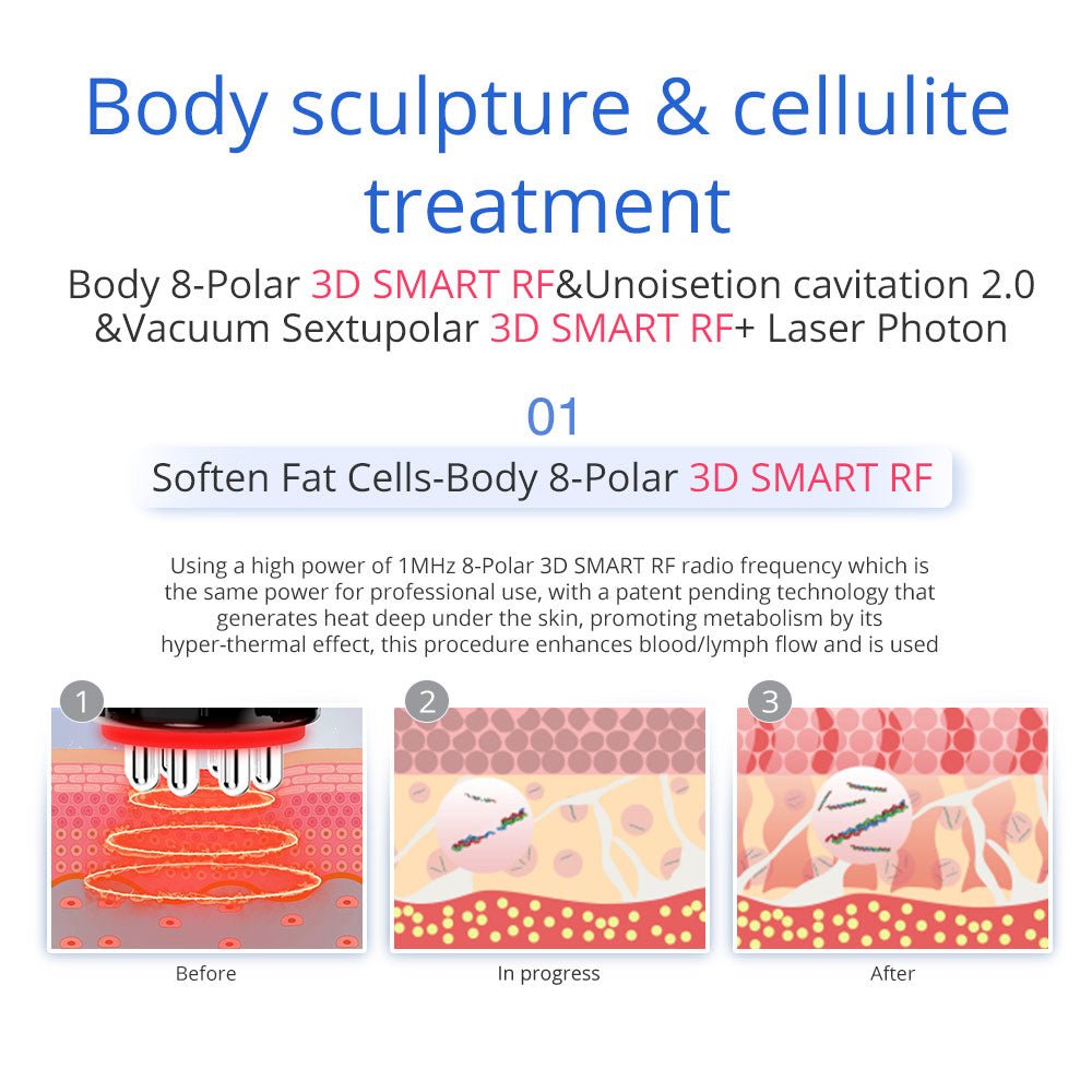 Shape Tactics 7-in-1 40K Ultrasonic Cavitation & RF Hot-Cold Therapy System