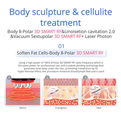 Shape Tactics 7-in-1 40K Ultrasonic Cavitation & RF Hot-Cold Therapy System