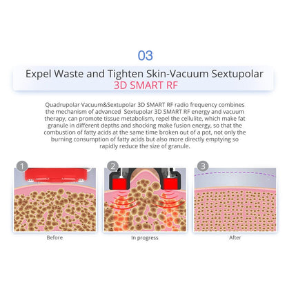 Shape Tactics 7-in-1 40K Ultrasonic Cavitation & RF Hot-Cold Therapy System