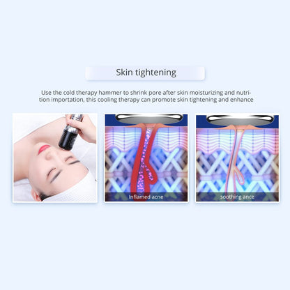 Shape Tactics 7-in-1 40K Ultrasonic Cavitation & RF Hot-Cold Therapy System