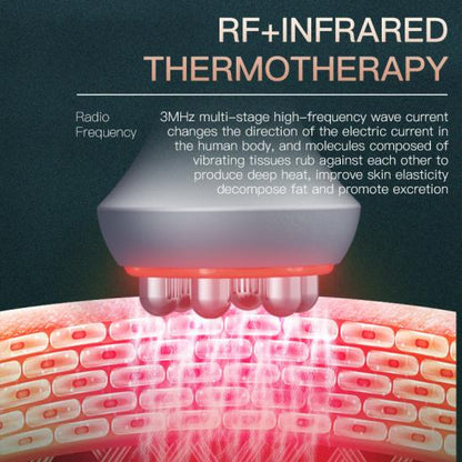 Shape Tactics ContourPro 5-in-1 80K Ultrasonic RF System