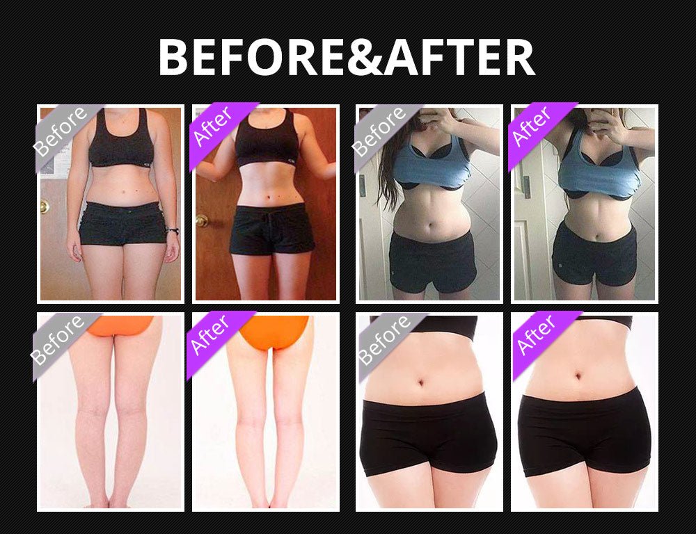 Shape Tactics 5-in-1 Ultrasonic Cavitation Vacuum RF Beauty System