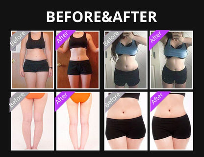 Shape Tactics 5-in-1 Ultrasonic Cavitation Vacuum RF Beauty System