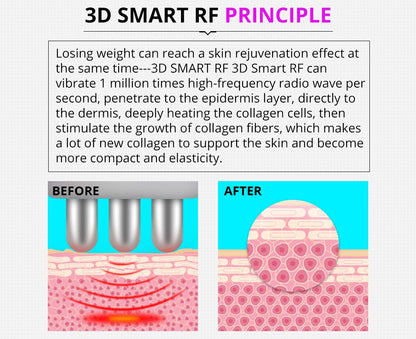 Shape Tactics 5-in-1 Ultrasonic Cavitation Vacuum RF Beauty System