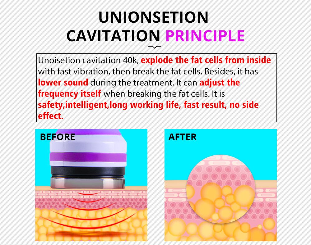 Shape Tactics 5-in-1 Ultrasonic Cavitation Vacuum RF Beauty System