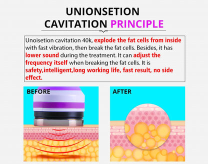 Shape Tactics 5-in-1 Ultrasonic Cavitation Vacuum RF Beauty System