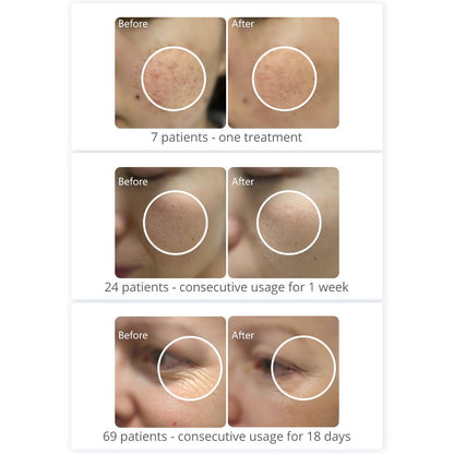 Shape Tactics PDT 408 LED Light Therapy System