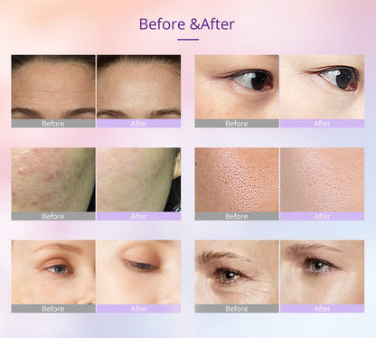 Shape Tactics Photon LED Facial Care Microcurrent Beauty Device