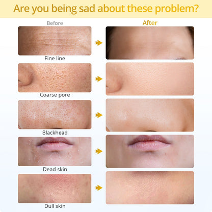 Shape Tactics Portable Diamond Microdermabrasion Device