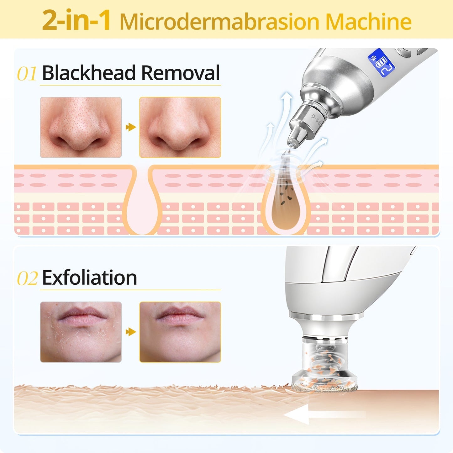 Shape Tactics Portable Diamond Microdermabrasion Device