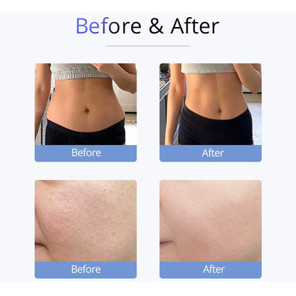 Shape Tactics S-Shape 30K Ultrasonic Cavitation & RF Vacuum Therapy System