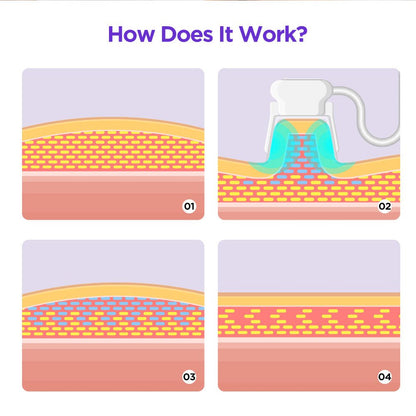 Shape Tactics Tri-Handle Cryolipolysis Contouring System